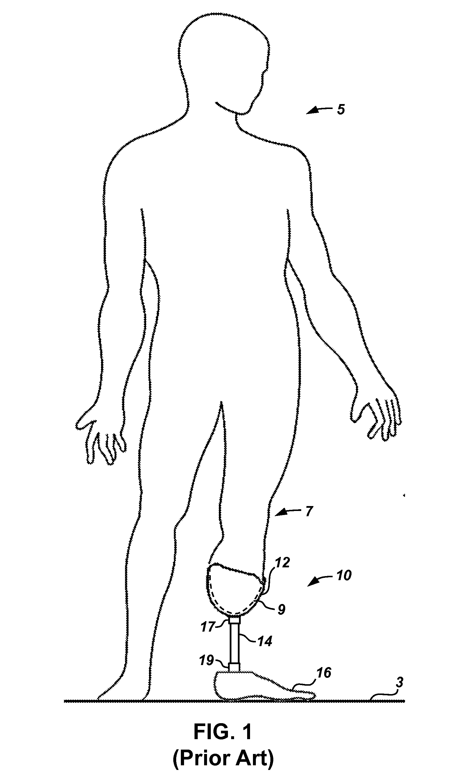 Composite pylon for a prosthetic device