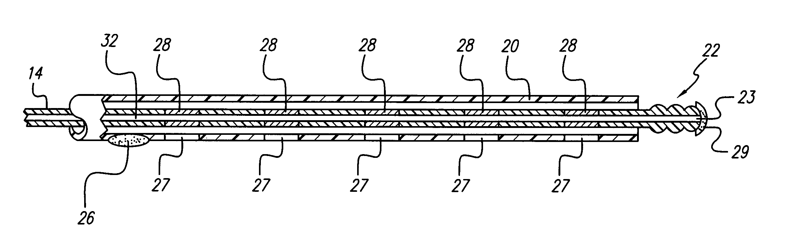 System and method for lead fixation