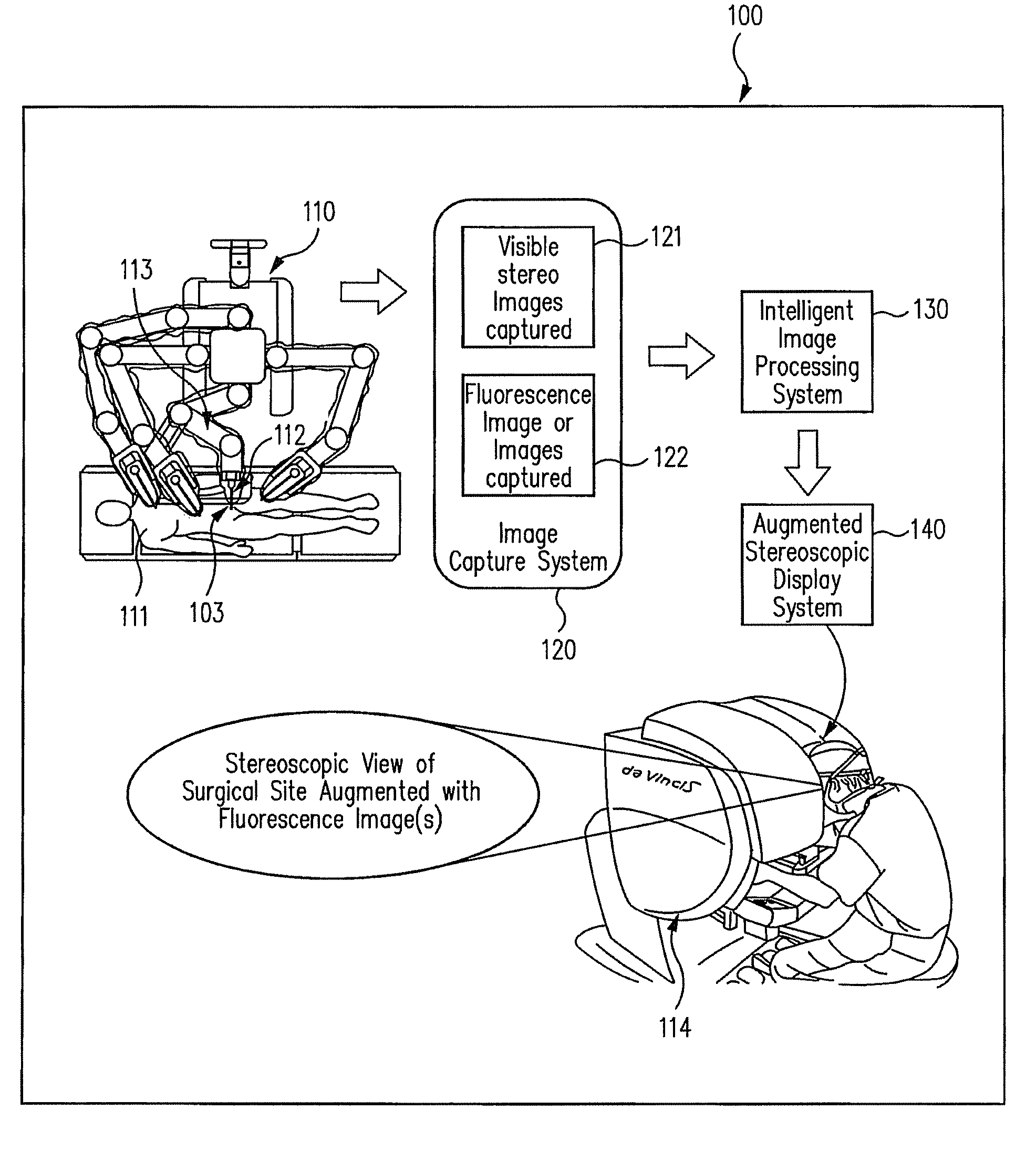 Augmented stereoscopic visualization for a surgical robot