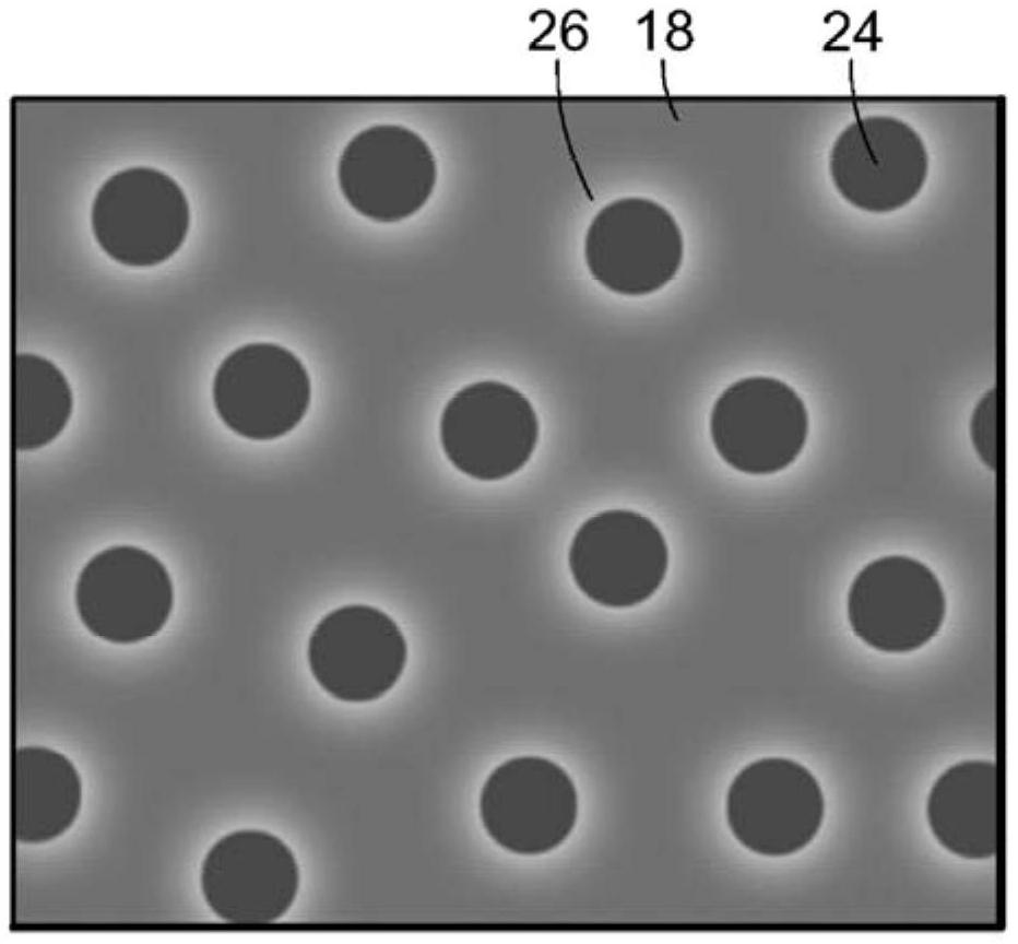 Systems and methods for neuroprotective therapy of glaucoma