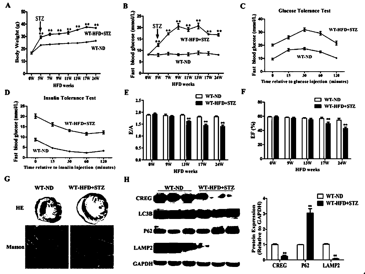 Medical application of CREG protein in prevention or treatment of diabetic cardiomyopathy