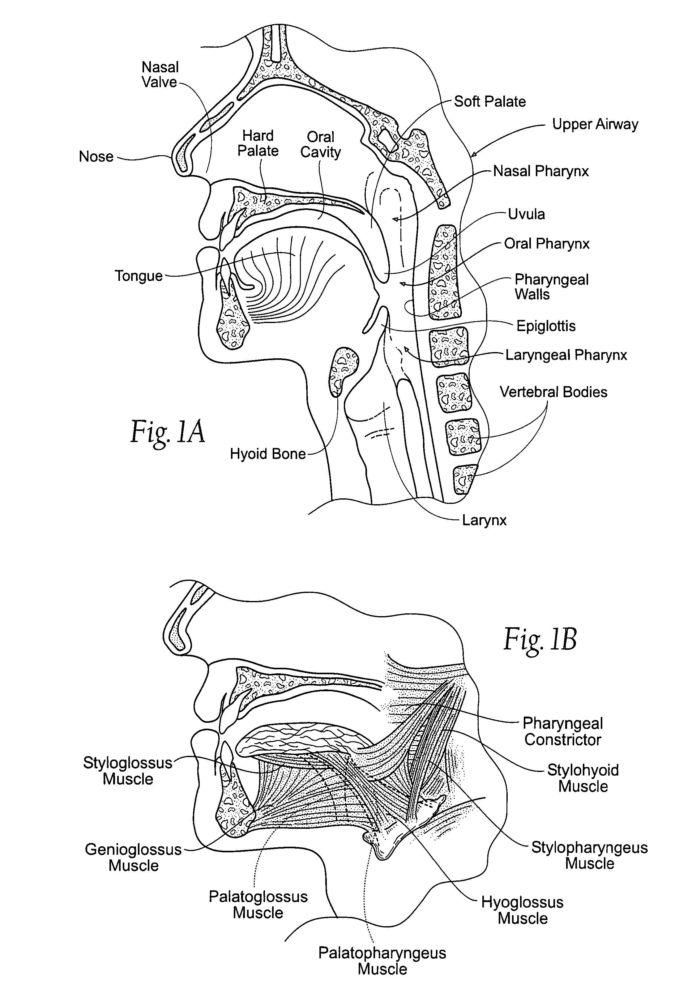 Implantable devices, systems, and methods for maintaining desired orientations in targeted tissue regions