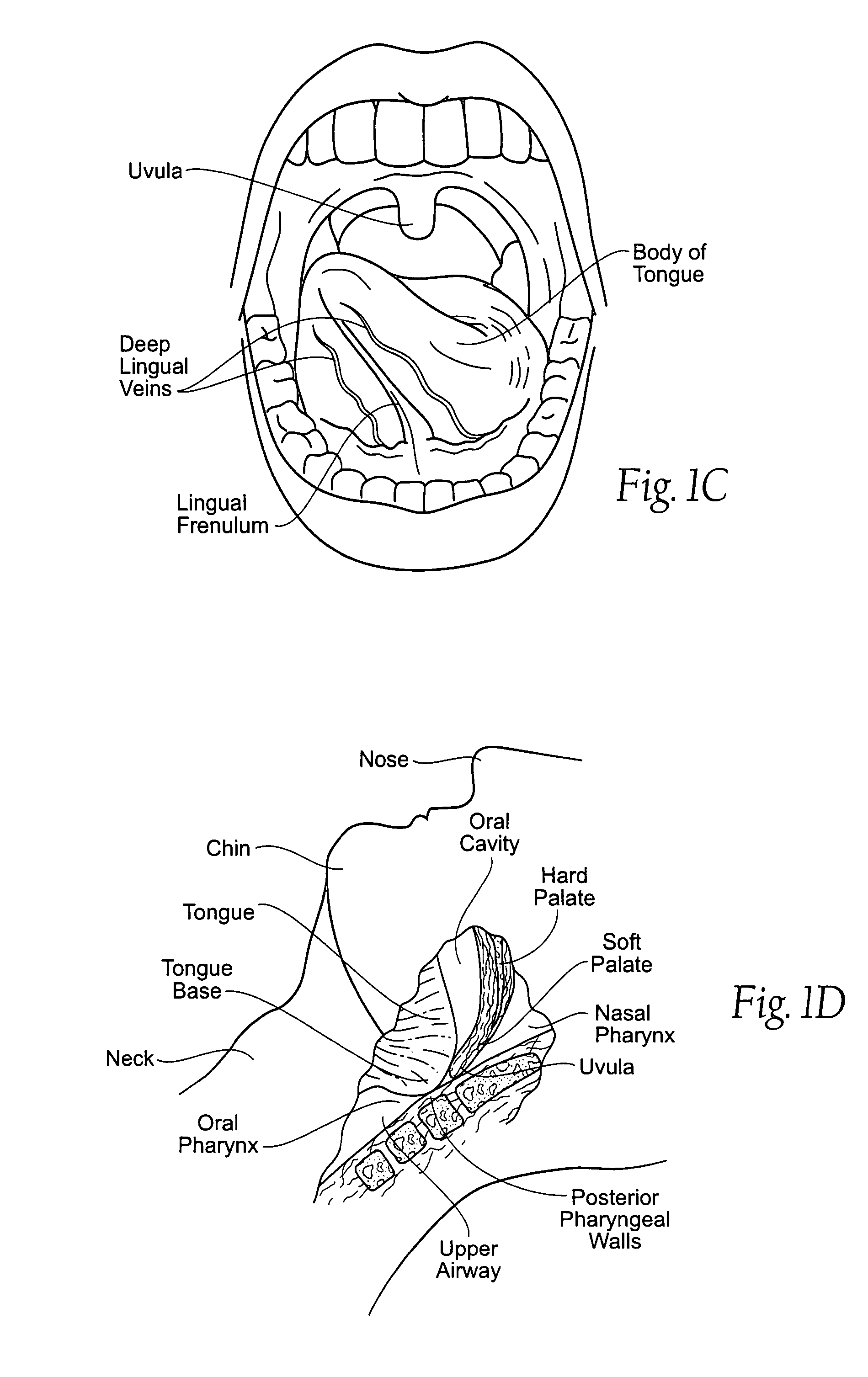 Implantable devices, systems, and methods for maintaining desired orientations in targeted tissue regions