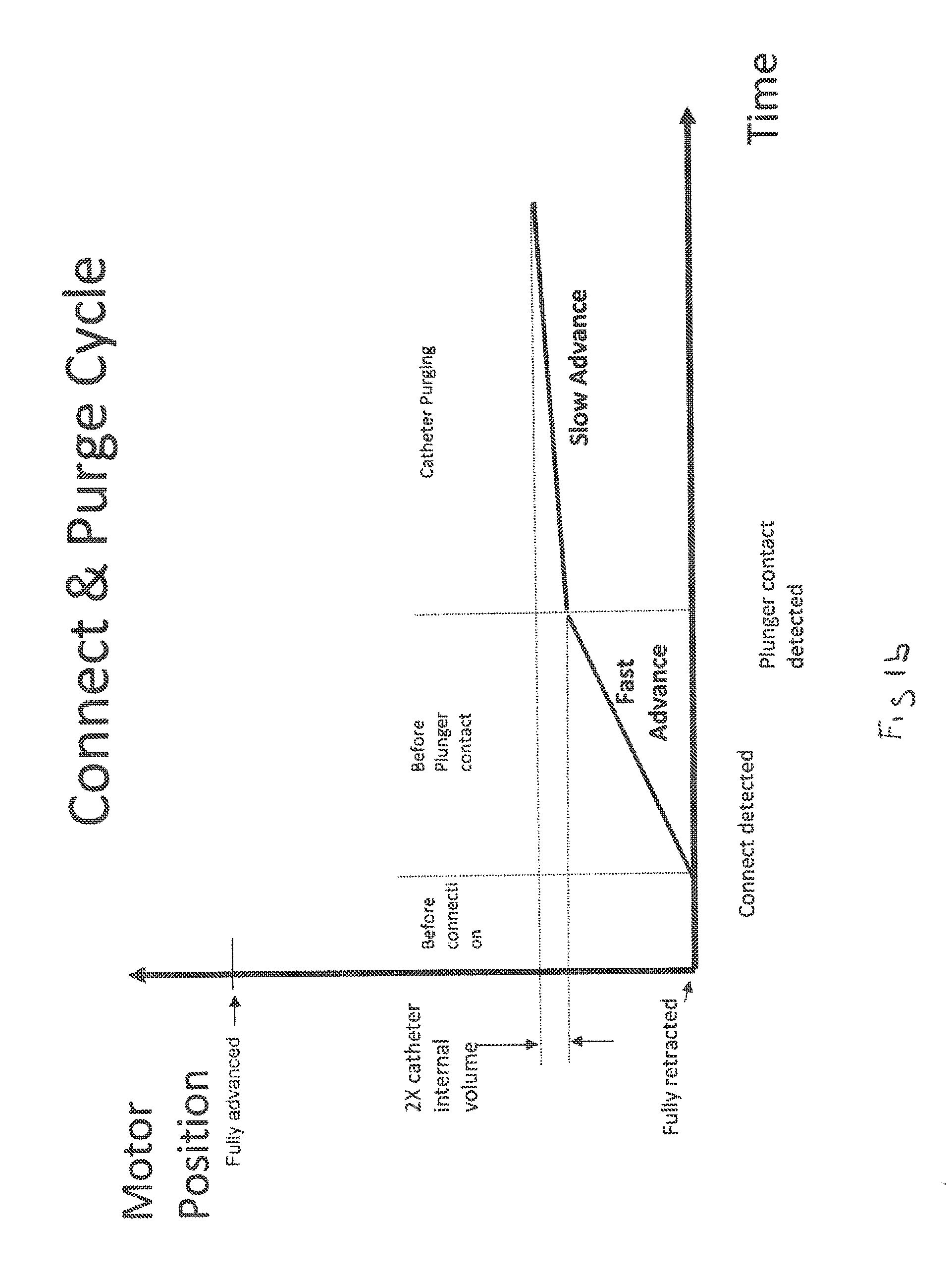 Automated Fluid Delivery Catheter and System