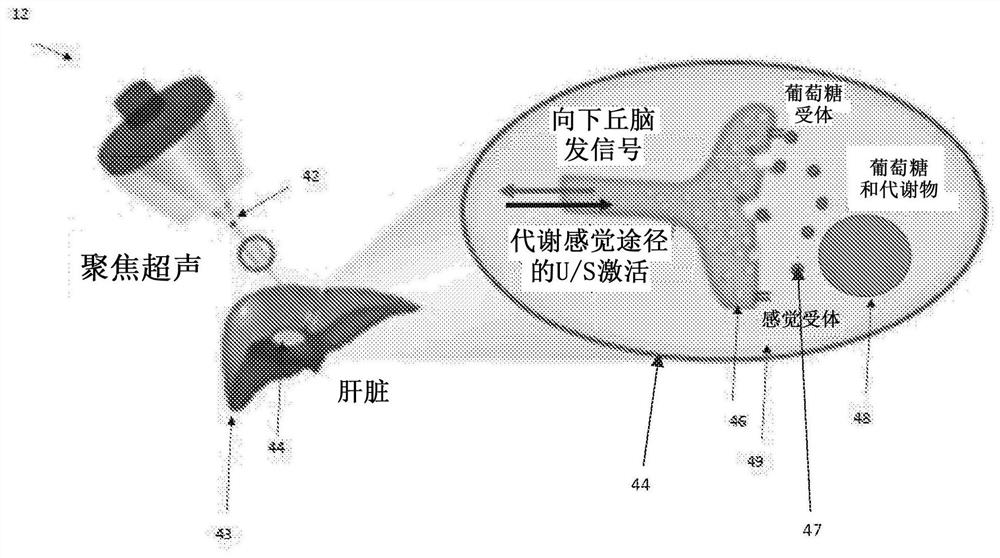 Ultrasound neuromodulation techniques