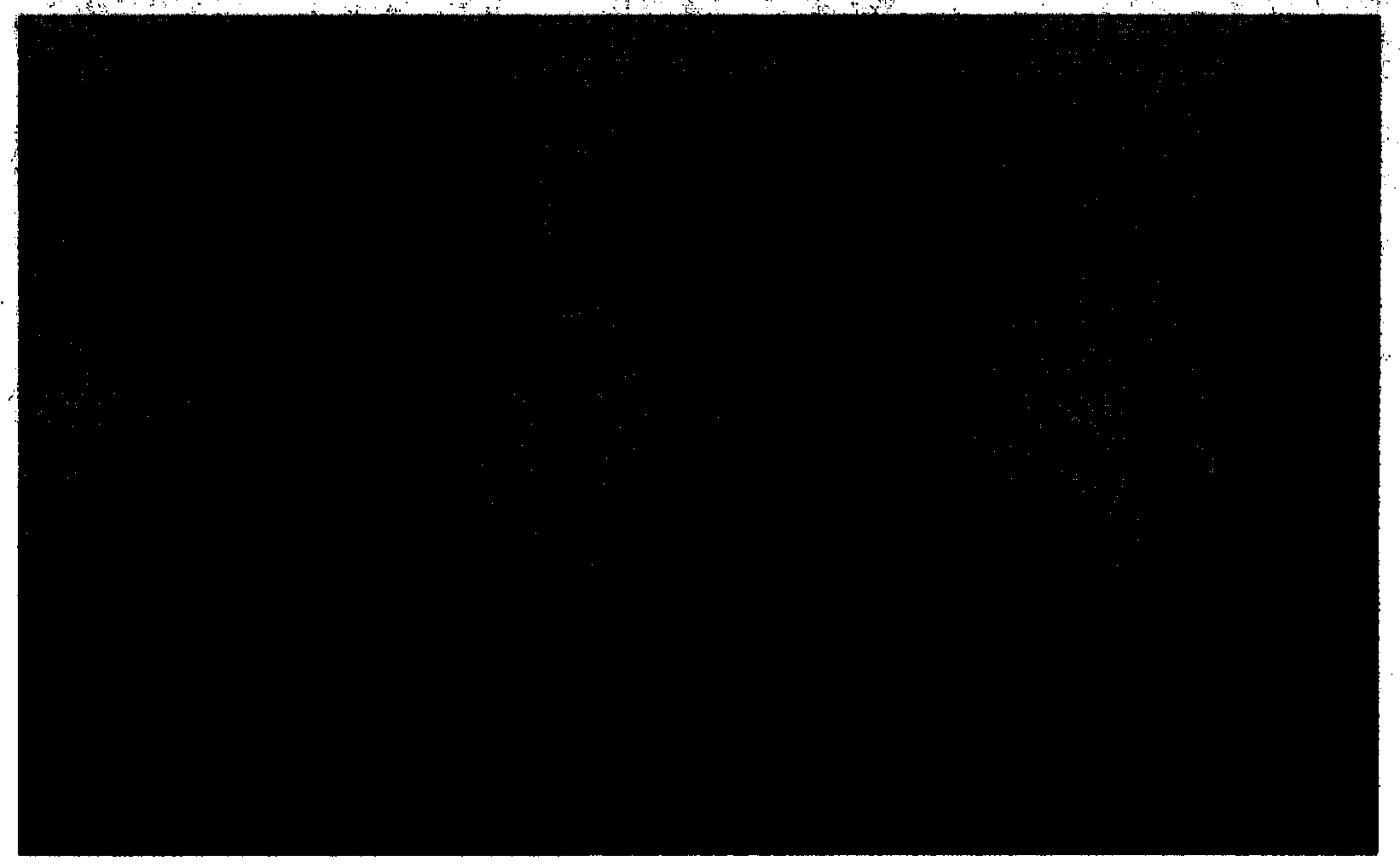 Medicine composition for preventing and/or treating diabetes and complication of diabetes