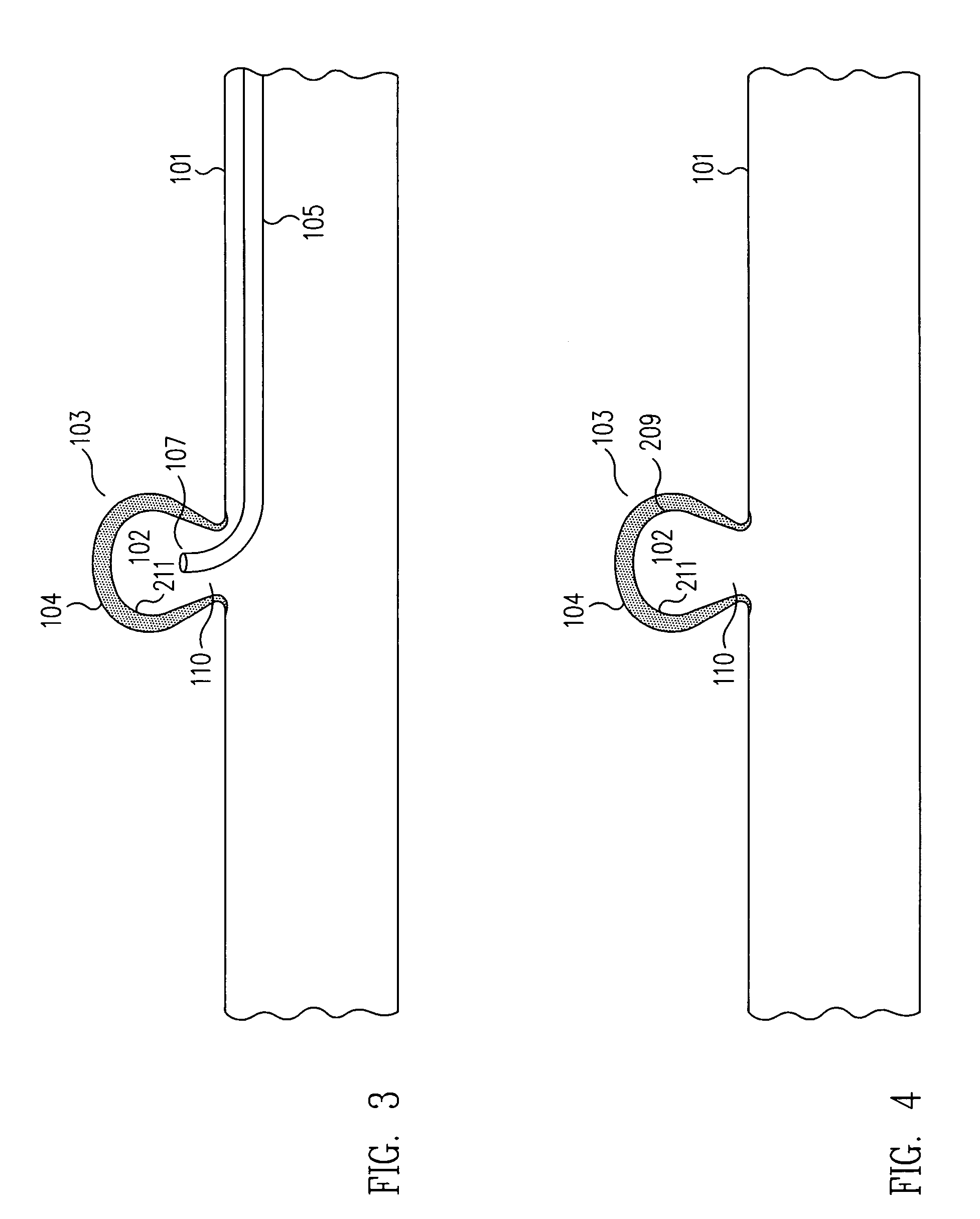 Method and apparatus for aneurismal treatment