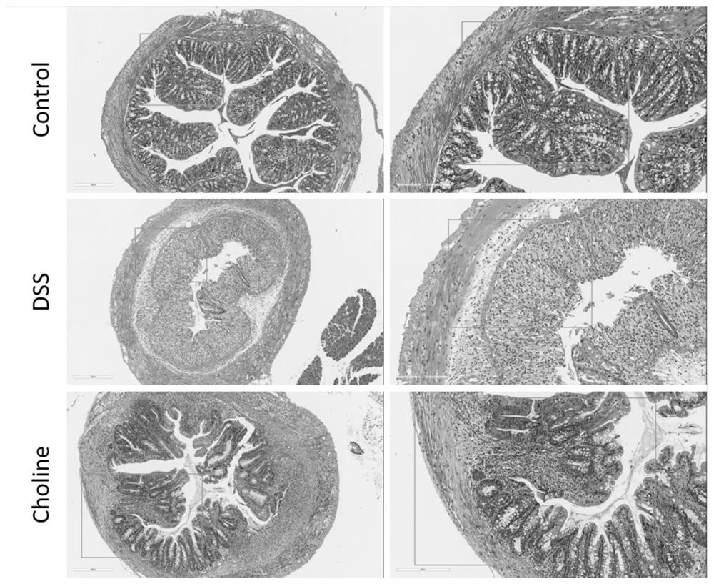 Application of choline chloride in relieving inflammatory bowel diseases