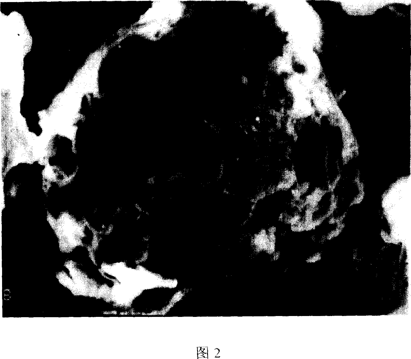 Lysine-chitosan resin and preparation method thereof