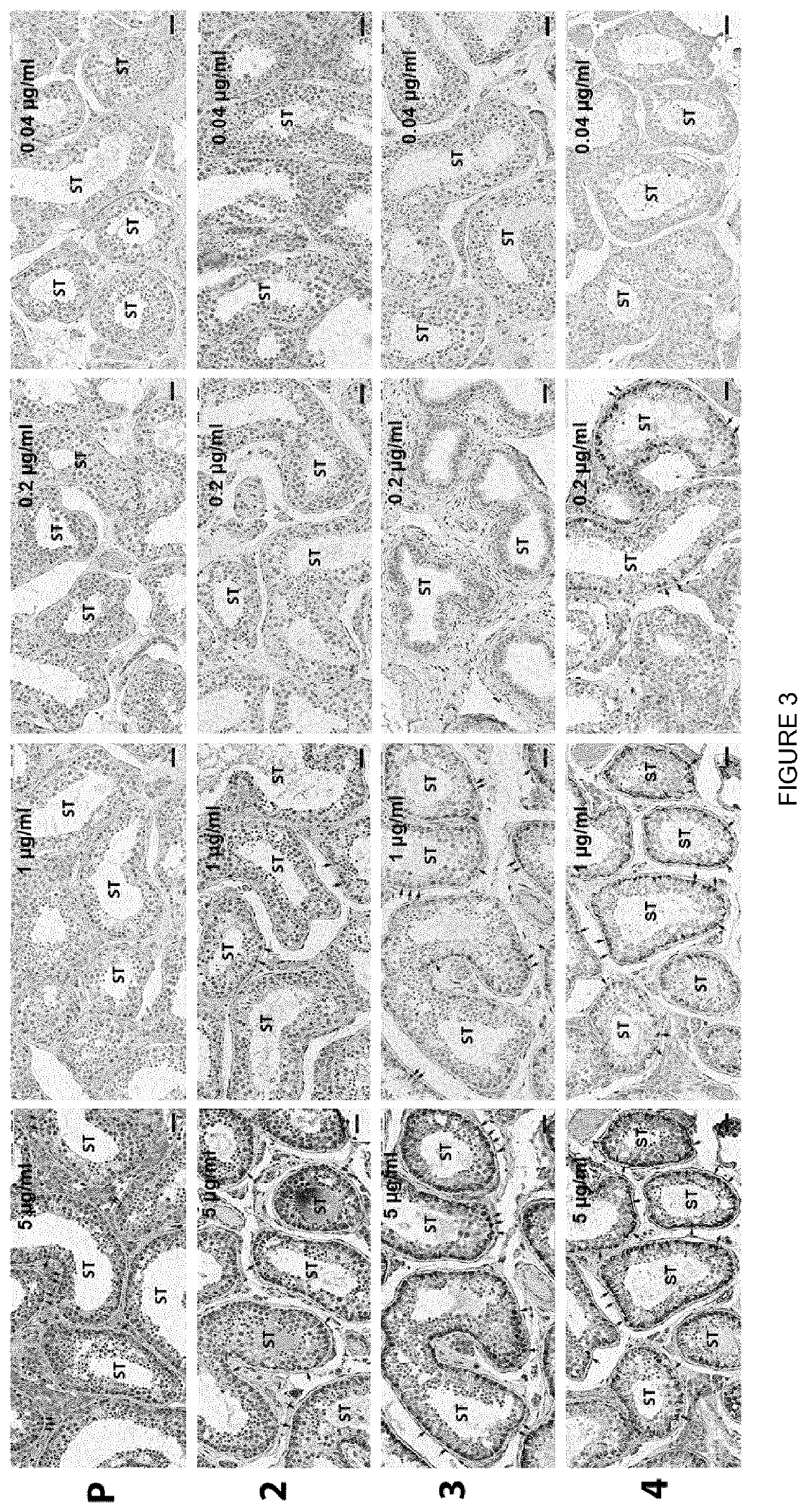 Antibodies against the human fshr extracellular domain