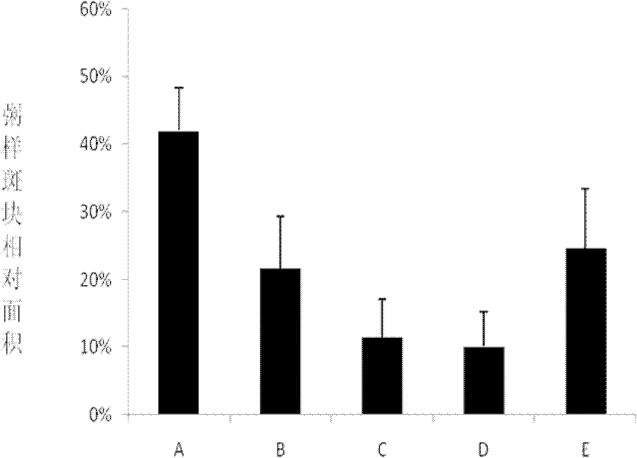 Pharmaceutical composition for treating atherosclerosis, and preparation method and application thereof