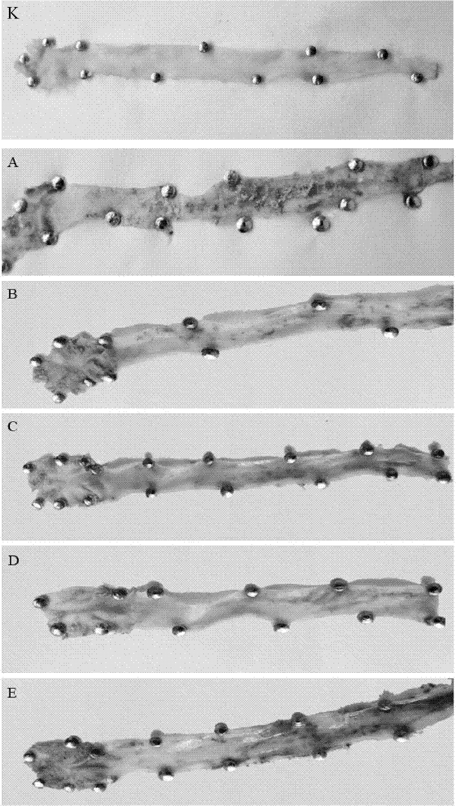 Pharmaceutical composition for treating atherosclerosis, and preparation method and application thereof