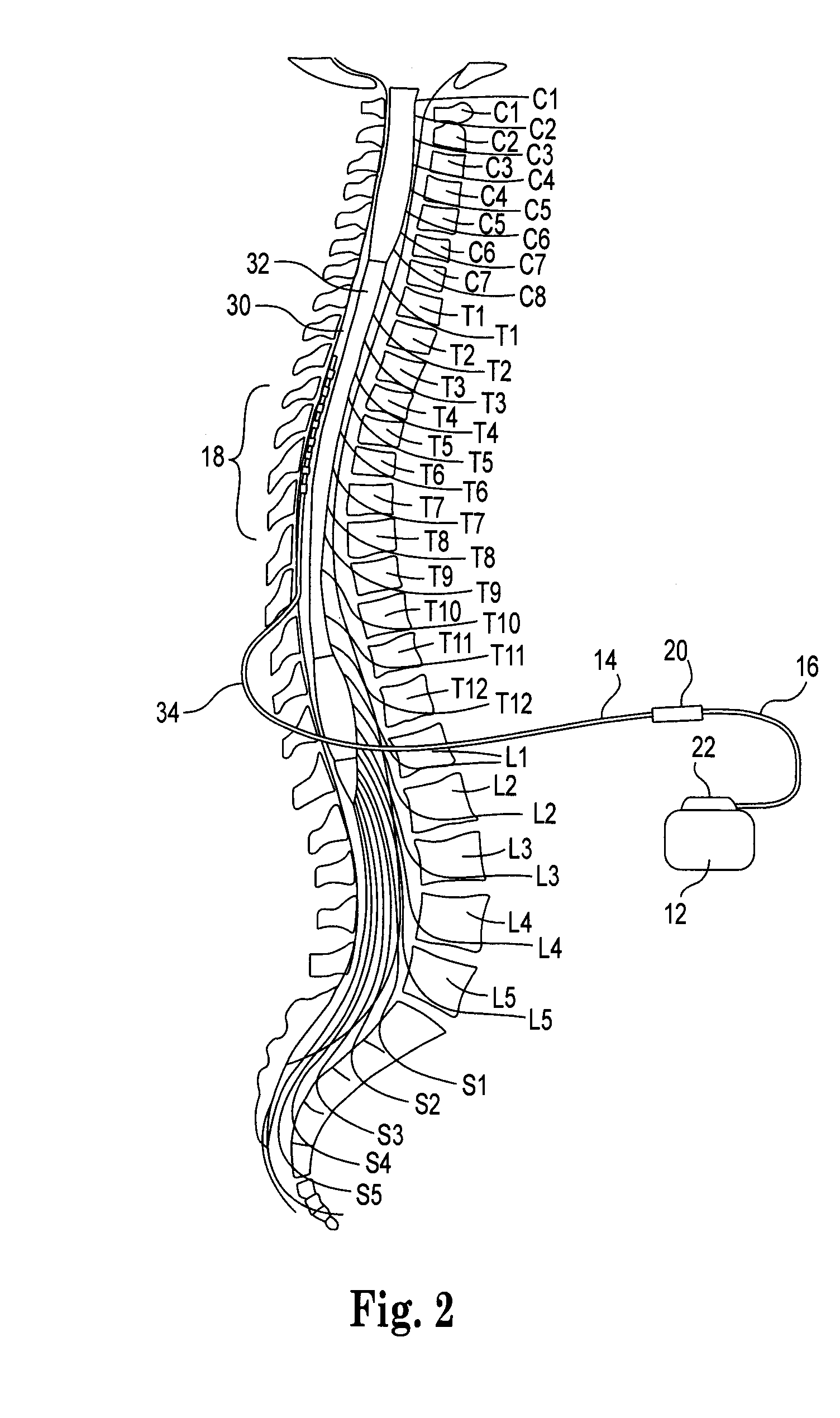 Low insertion force electrical connector for implantable medical devices