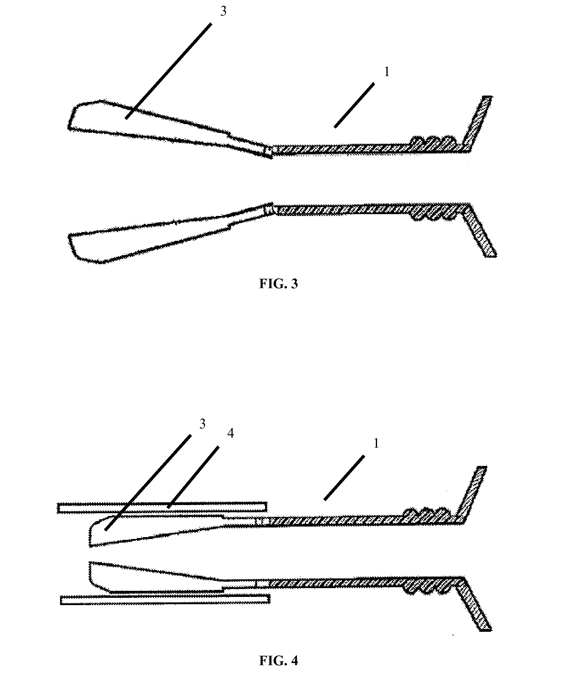 Universal anchor for bone fixation