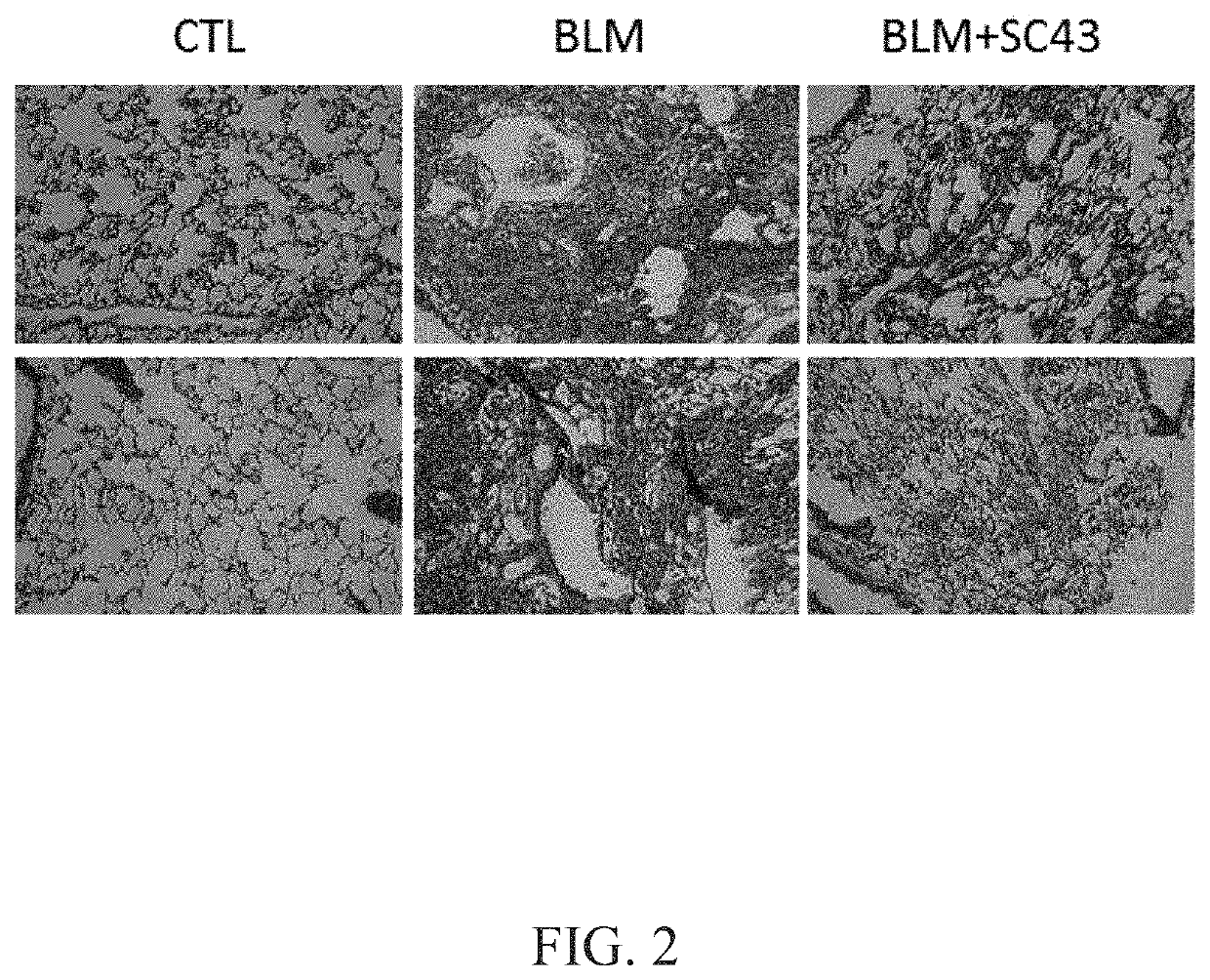 Method for ameliorating fibrosis using 1-[4-chloro-3-(trifluoromethyl)phenyl]-3-[3-(4-cyanophenoxy)phenyl]urea