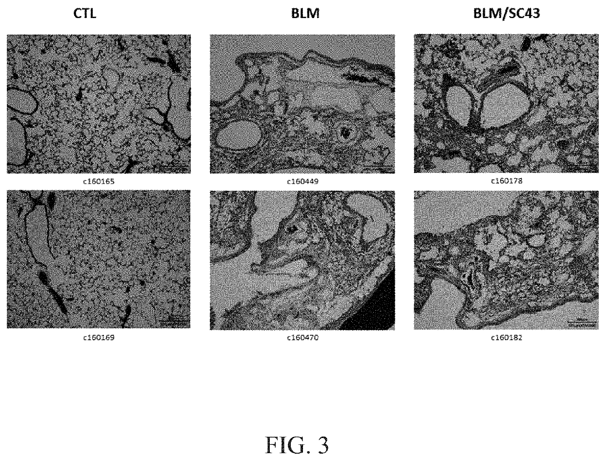 Method for ameliorating fibrosis using 1-[4-chloro-3-(trifluoromethyl)phenyl]-3-[3-(4-cyanophenoxy)phenyl]urea