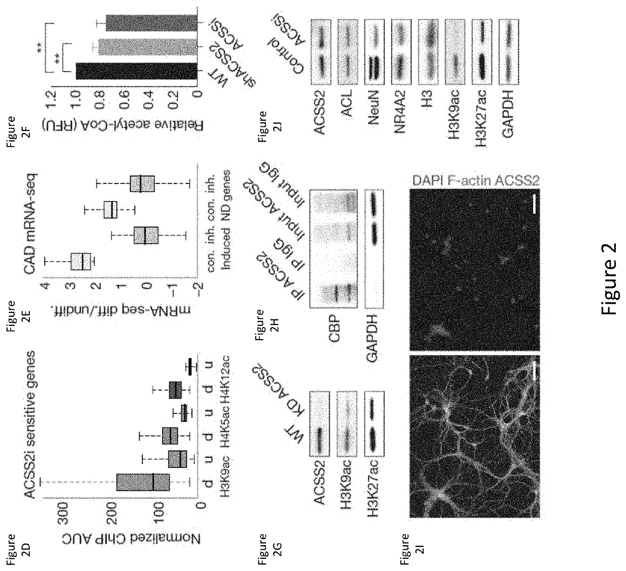 Compositions and methods for inhibiting acss2