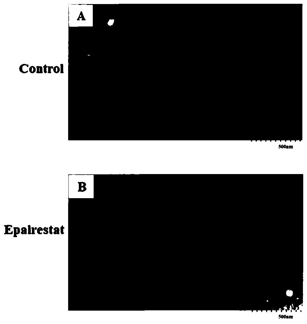 Application of epalrestat in preparation of pancreatic cancer drugs and method for verifying inhibiting effect on exosome secretion of pancreatic cancer cells