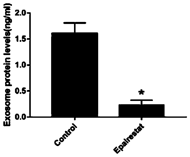 Application of epalrestat in preparation of pancreatic cancer drugs and method for verifying inhibiting effect on exosome secretion of pancreatic cancer cells