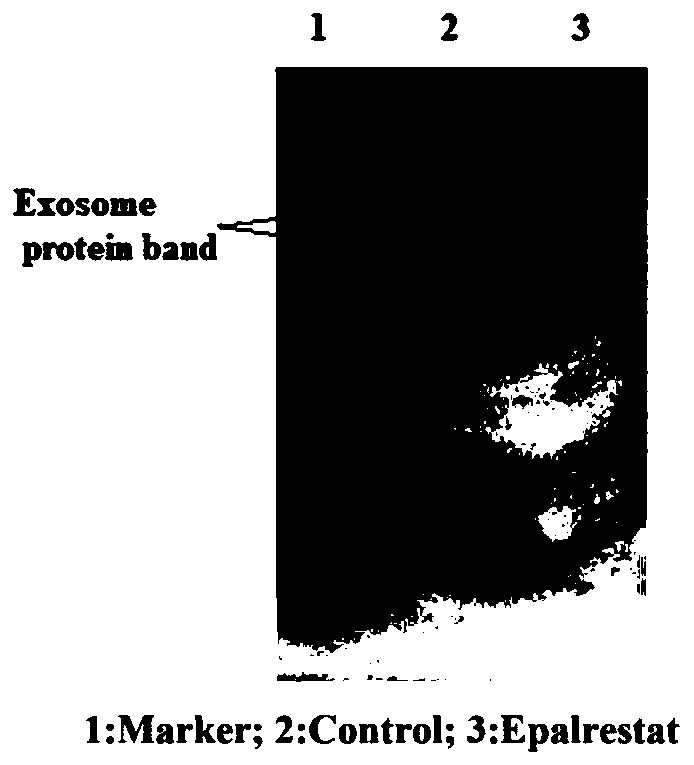 Application of epalrestat in preparation of pancreatic cancer drugs and method for verifying inhibiting effect on exosome secretion of pancreatic cancer cells