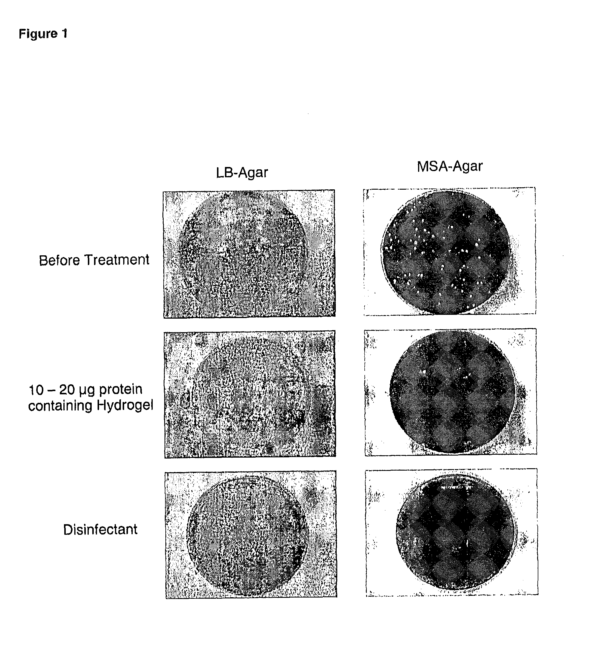 Chimeric polypeptides and their use in bacterial decolonization