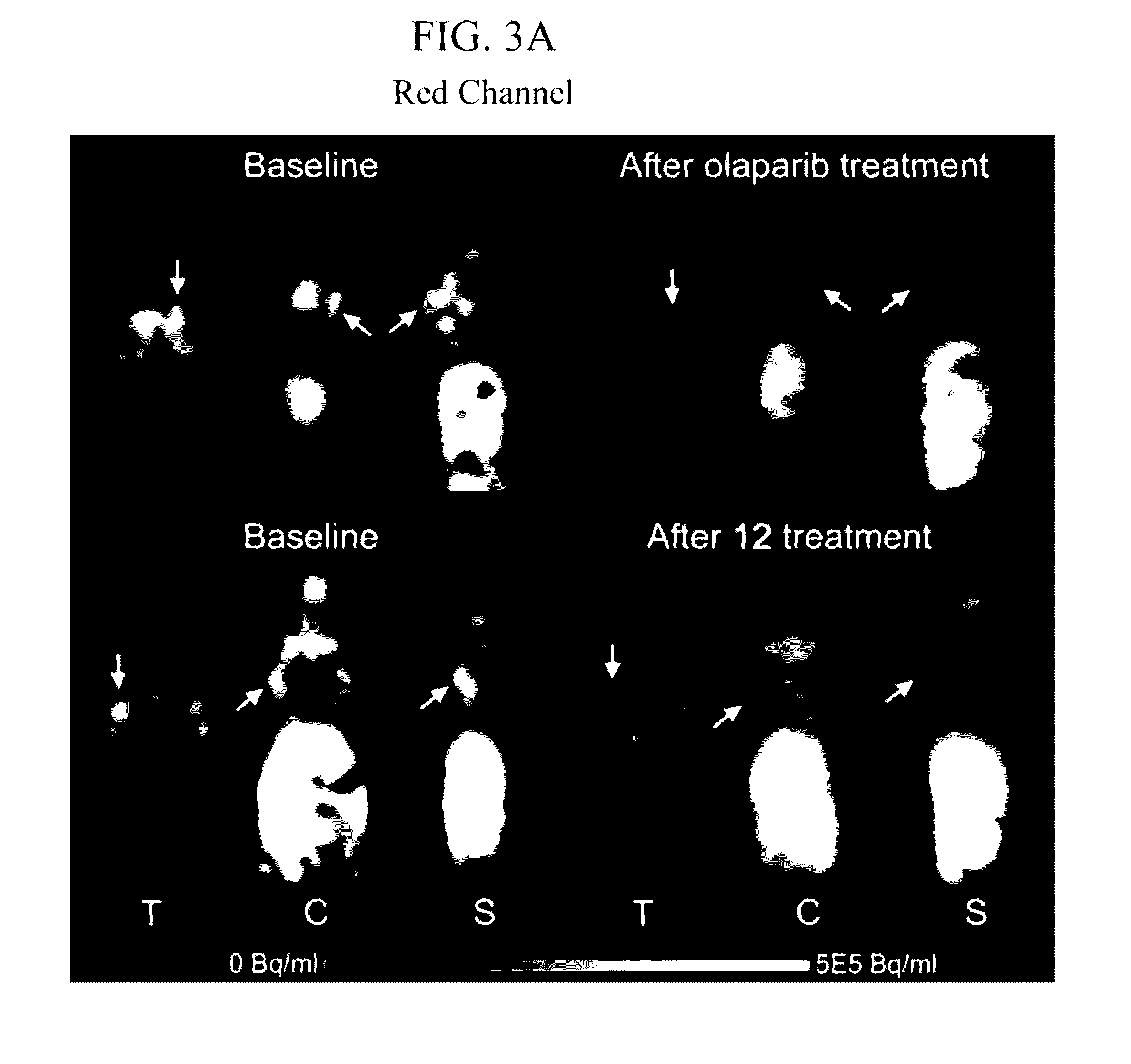 Radiolabeled tracers for poly (adp-ribose) polymerase-1 (parp-1), methods and uses therefor