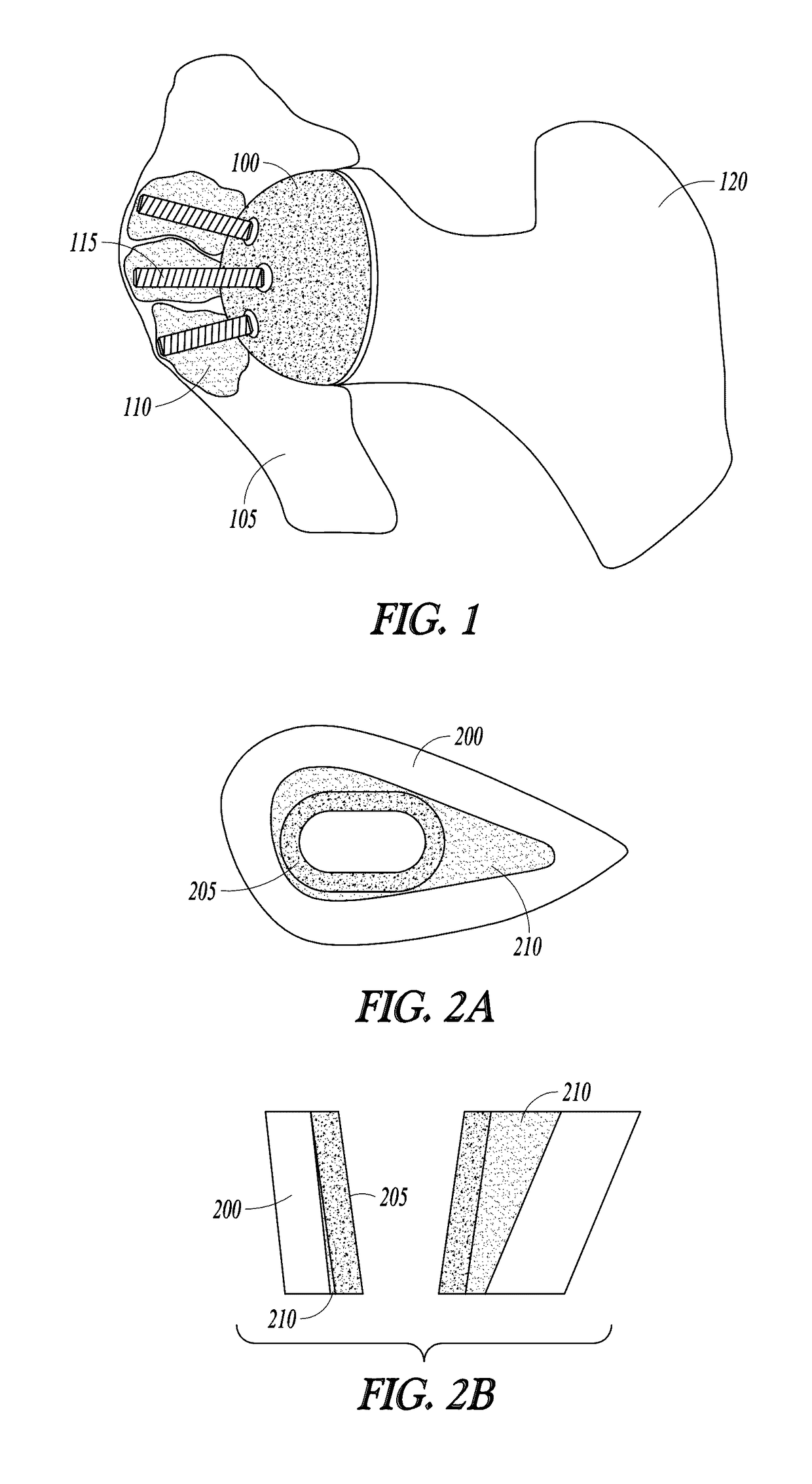 Curable calcium phosphate compositions for use with porous structures and methods of using the same