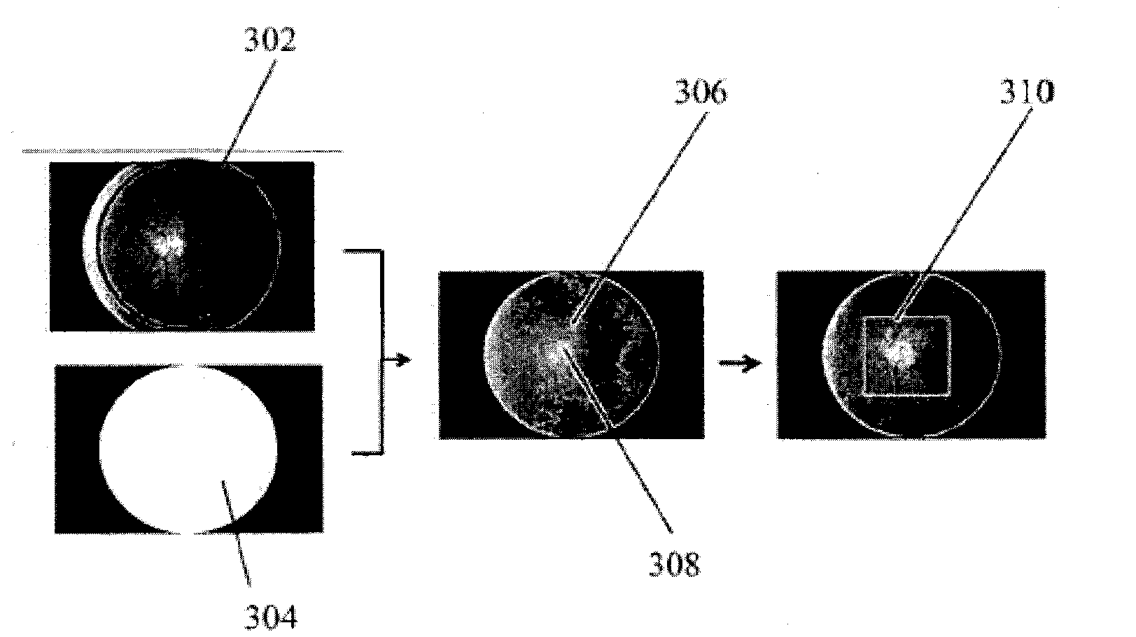 Method and system for detecting disc haemorrhages