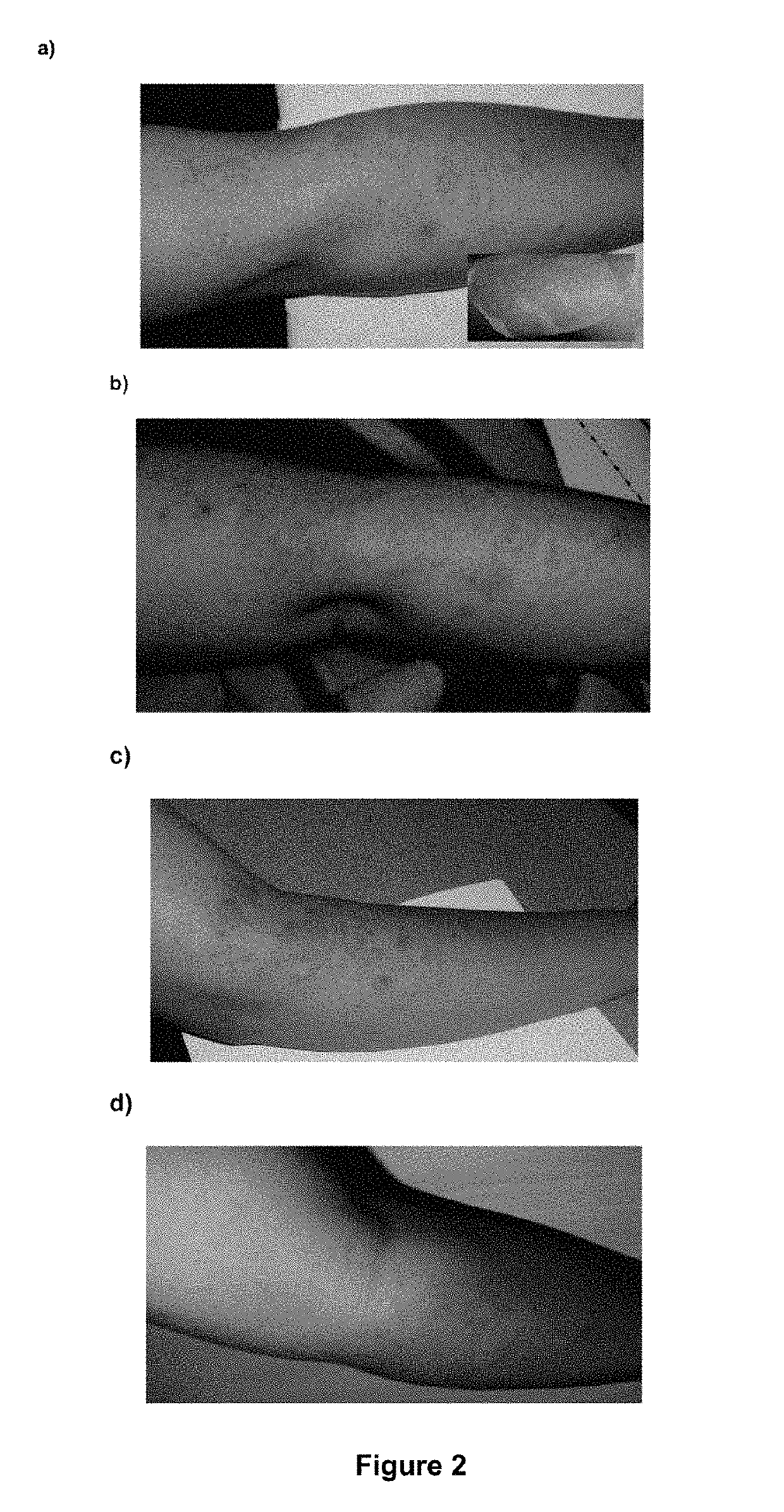 Pharmaceutical composition for preventing, treating, and curing psoriasis including snail slime, chamomile, and honey