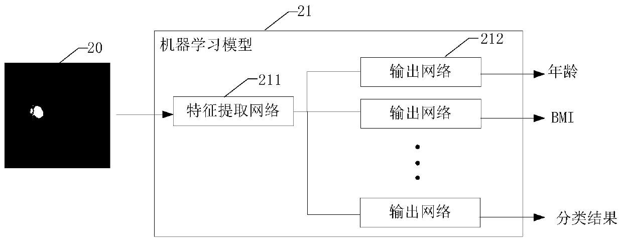 Diabetes classification method and device based on fundus images