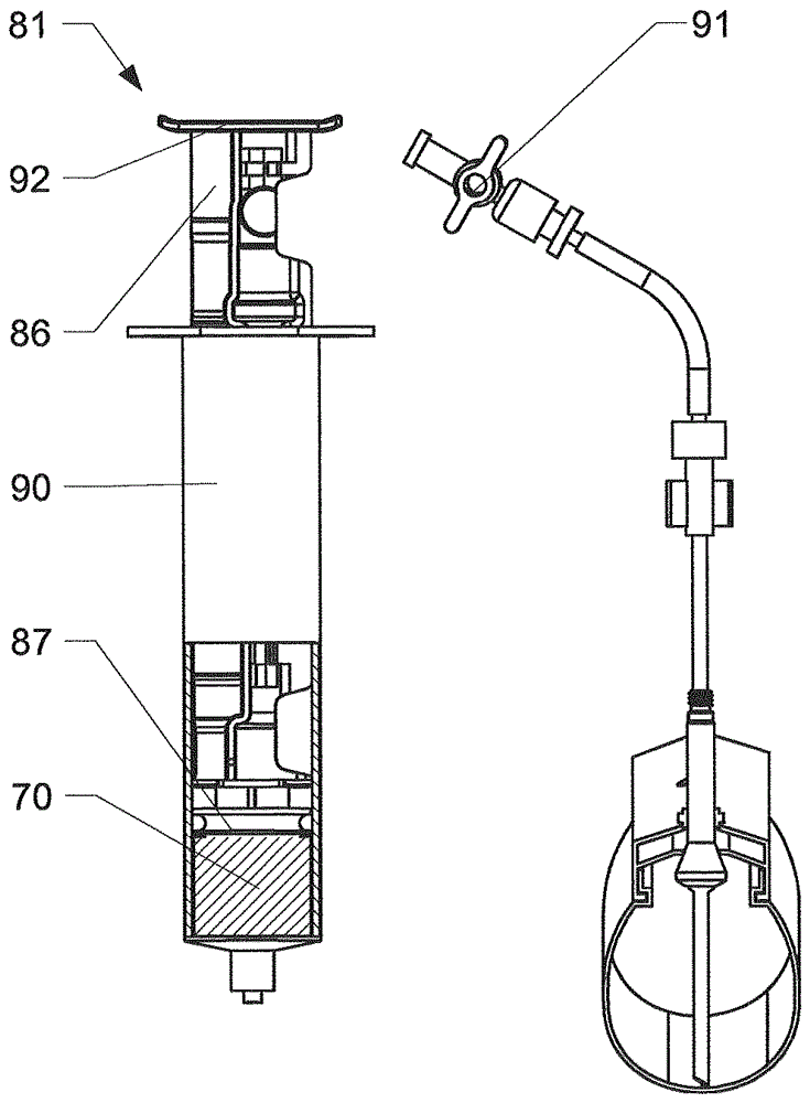 Valve for tubeless tires