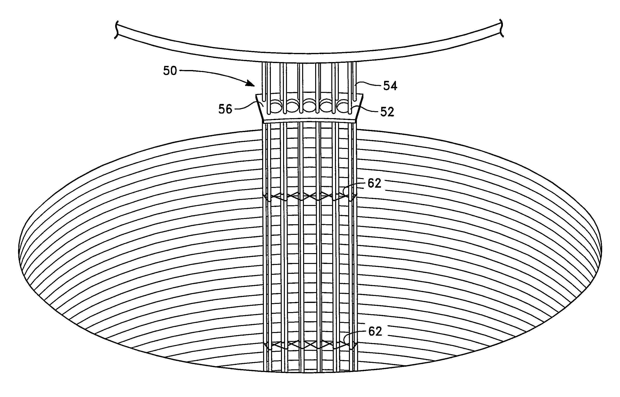 Apparatus and method for installing anchor bolts in a cylindrical pier foundation