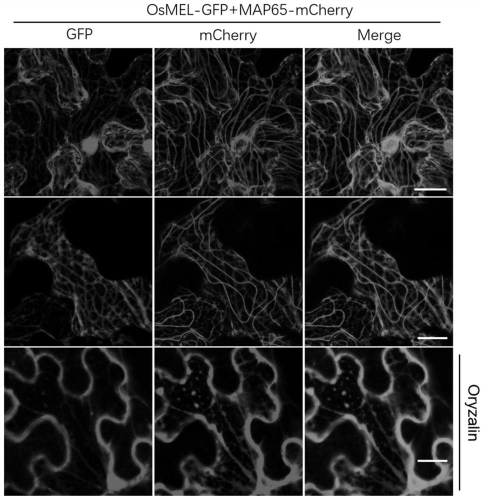 Plant immunoregulation related protein and application thereof