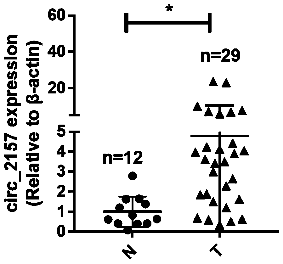 Application of circ_2157 in preparation of therapeutic preparation for nasopharyngeal carcinoma and therapeutic preparation