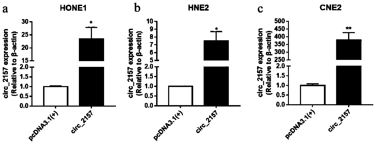 Application of circ_2157 in preparation of therapeutic preparation for nasopharyngeal carcinoma and therapeutic preparation