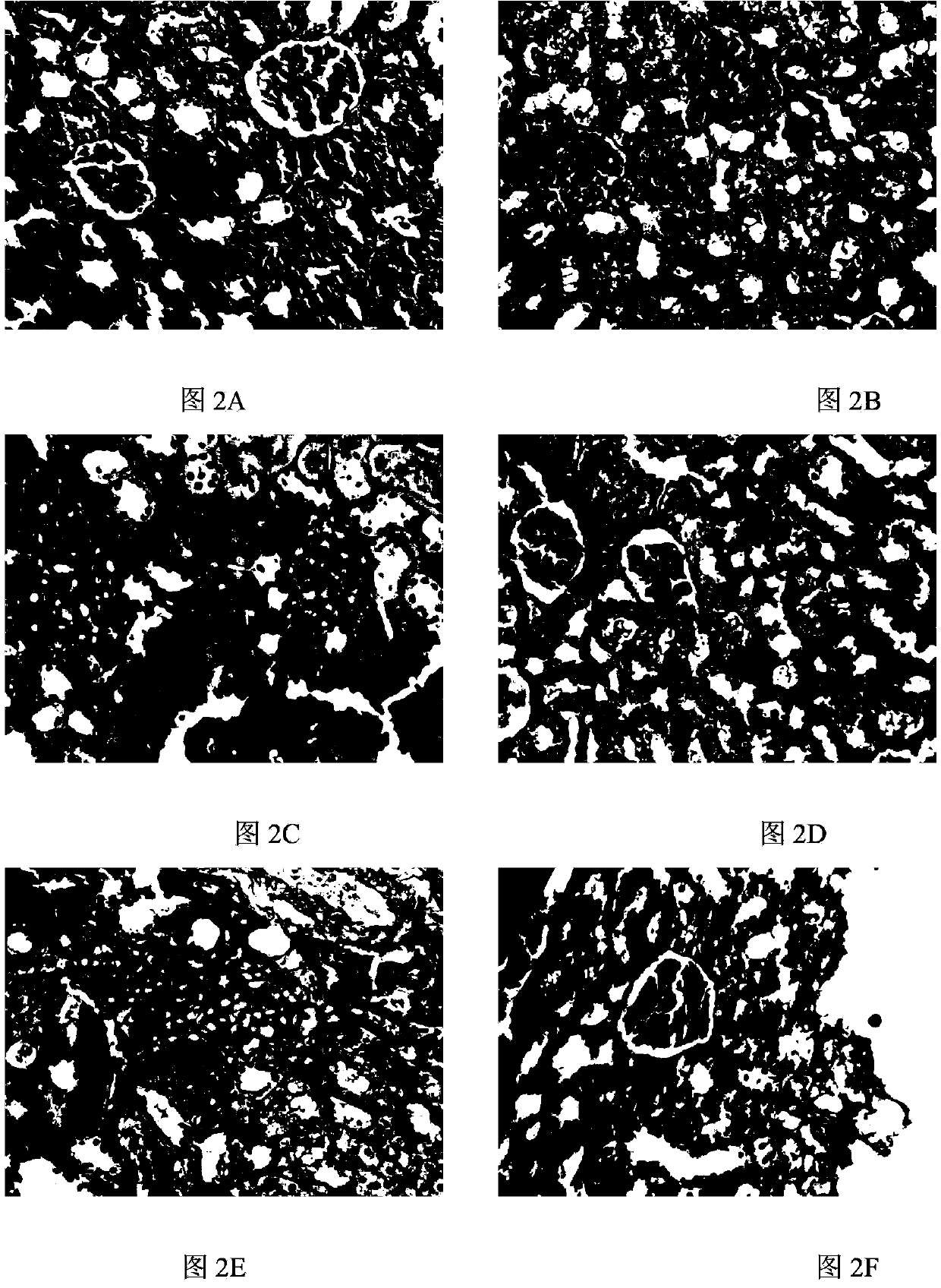 Pharmaceutical composition for prevention and treatment of chronic glomerular diseases and preparation method of pharmaceutical composition