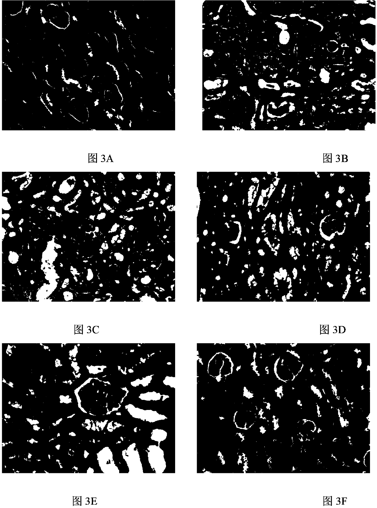 Pharmaceutical composition for prevention and treatment of chronic glomerular diseases and preparation method of pharmaceutical composition