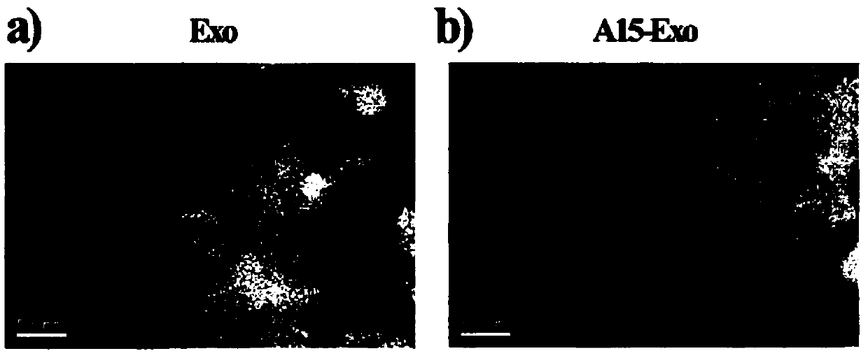 Exosome carrier of target integrin alpha v beta 3 and preparation method and application of exosome carrier