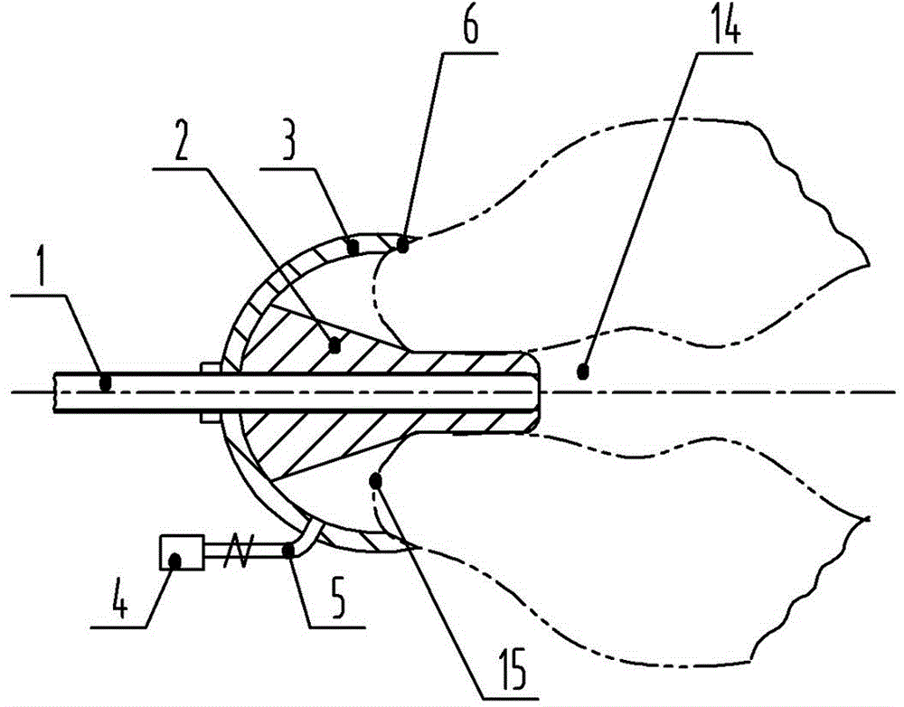 Sucking disc type external external-fixation uterus and oviduct radiography appliance