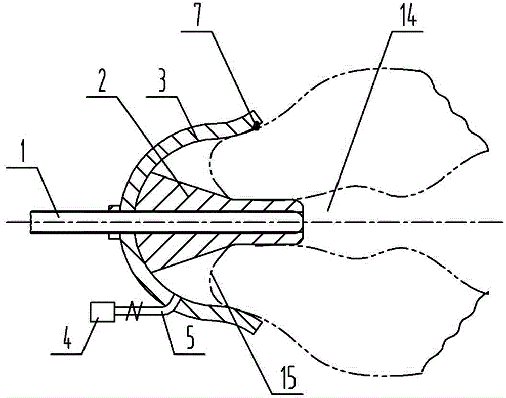 Sucking disc type external external-fixation uterus and oviduct radiography appliance