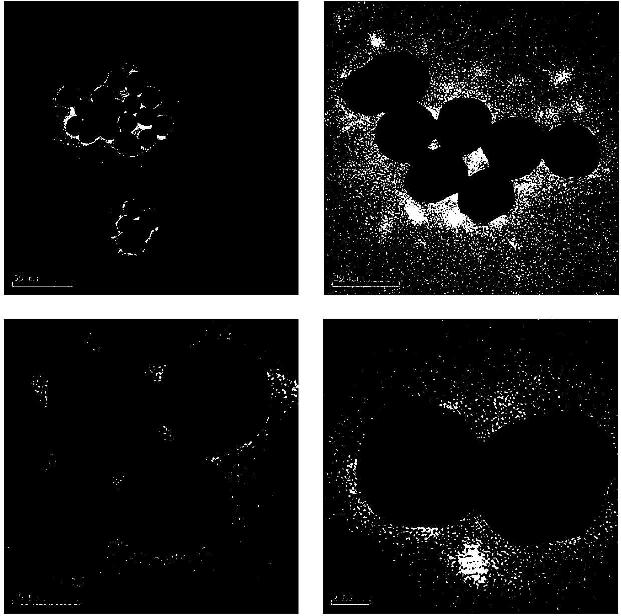 Electrochemical immunosensor, and preparation method and application thereof