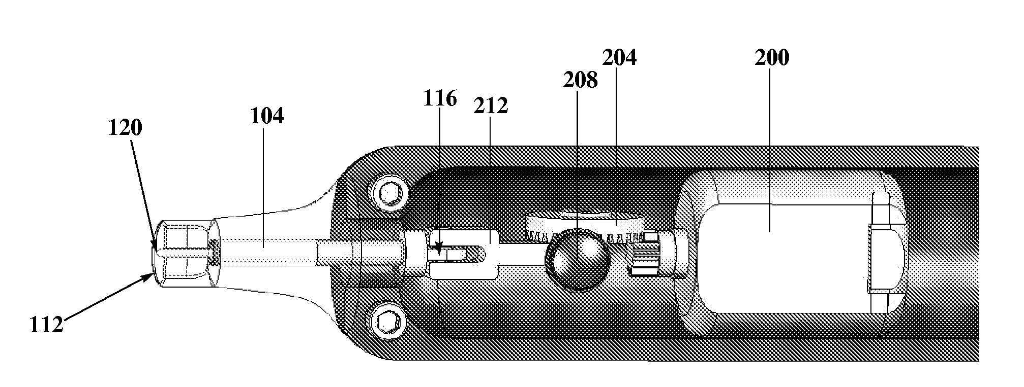 Non-invasive device for lowering intraocular pressure