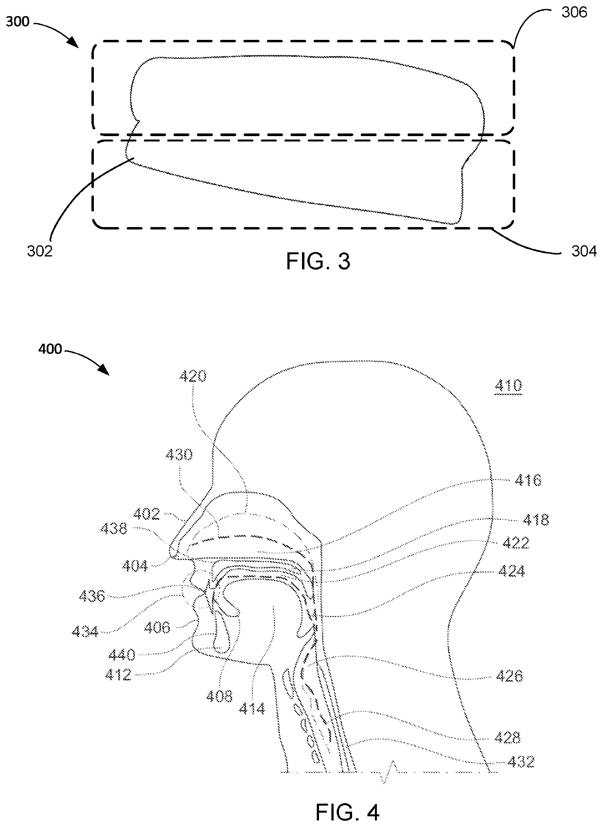 Oral appliance apparatus and method of operation thereof