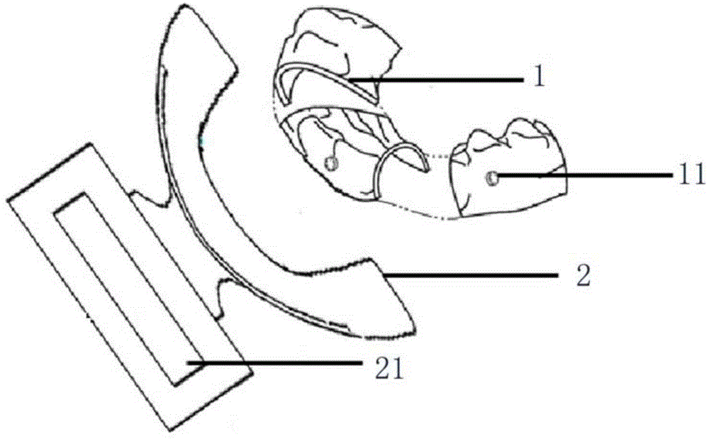 Wireless orthodontic auxiliary treatment apparatus