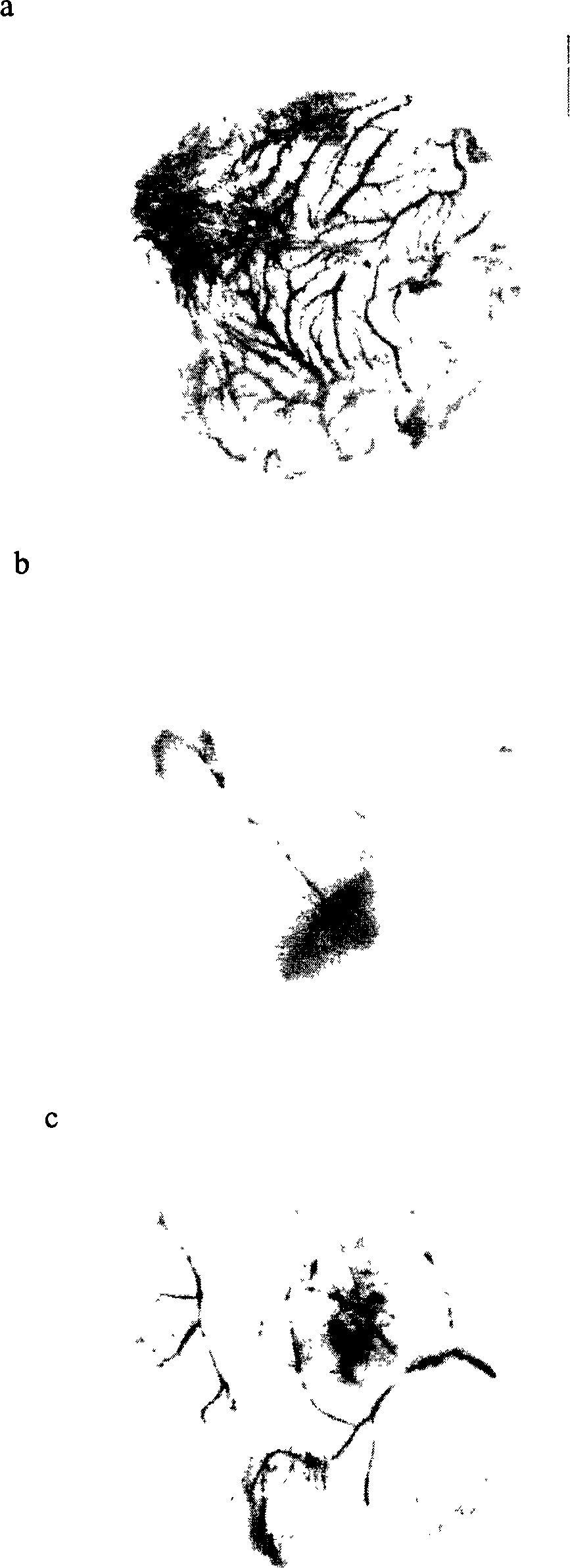 Artesunate and dihydroarteannuin medicine preparation for proofing formation of blood vessel and use thereof