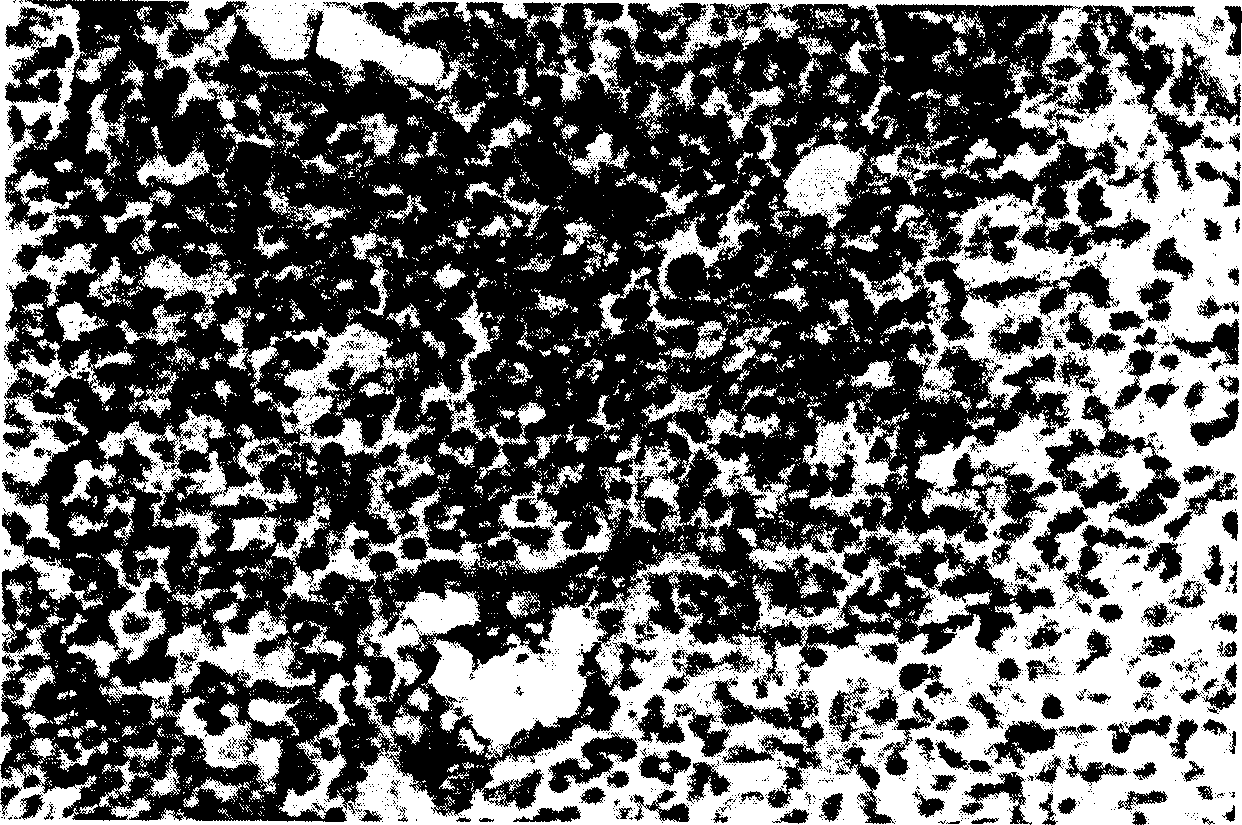 Artesunate and dihydroarteannuin medicine preparation for proofing formation of blood vessel and use thereof