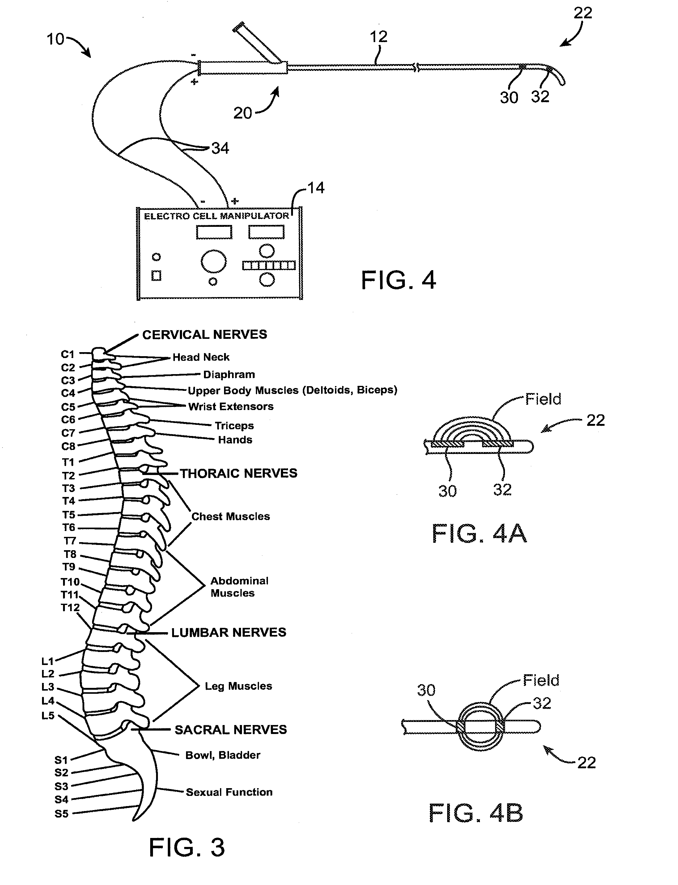 Systems and methods for neuromodulation for treatment of pain and other disorders associated with nerve conduction