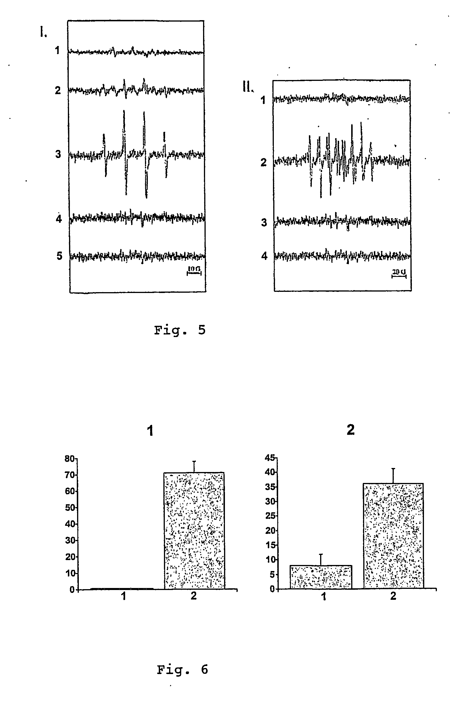 Pharmaceutical composition for the treatment and/or the prevention of atherosclerosis from infectious origin