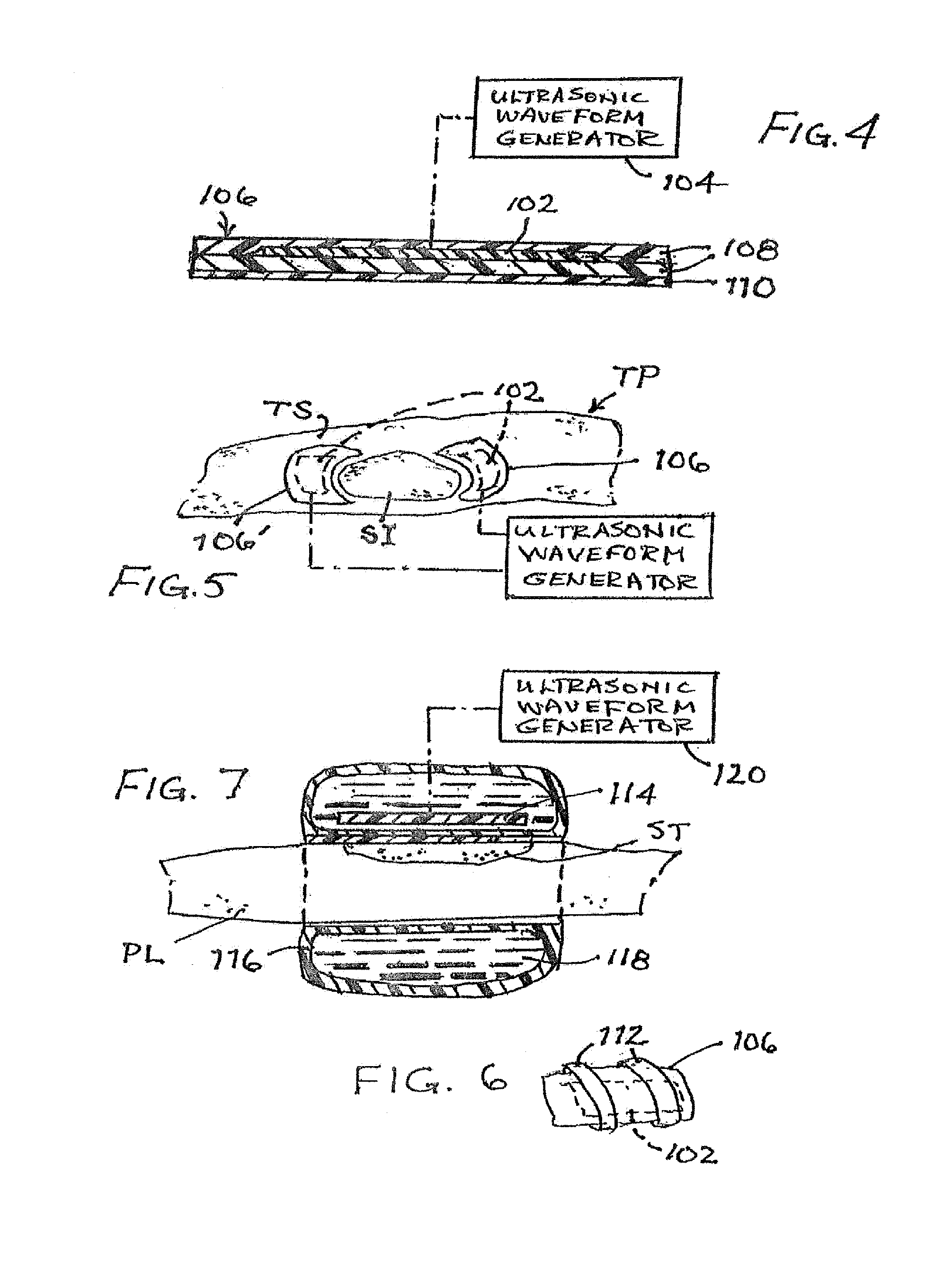 Method for reducing biofilm formation