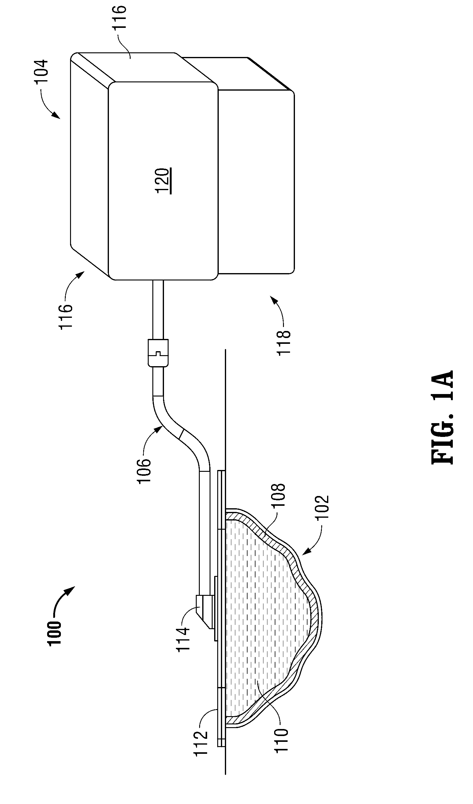 Wound Therapy System